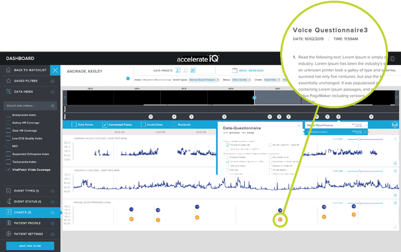 accelerateIQ Point Measurements Data Collection