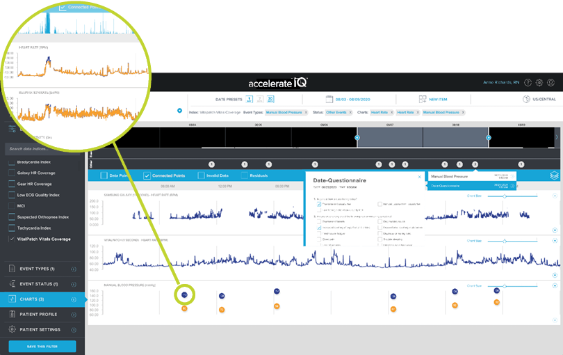 accelerateIQ screen Voice Capture Data Collection