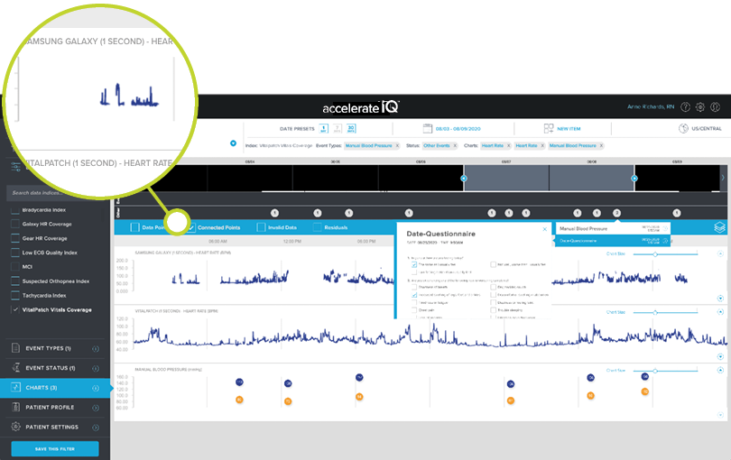 accelerateIQ screen zoom Continuous Physiological Data Collection